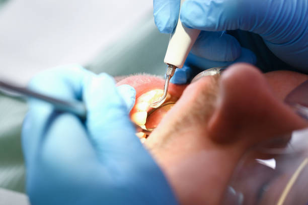 Best Emergency Gum Treatment in Gilbert, AZ